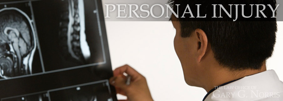 Personal Injury recommended lawyers