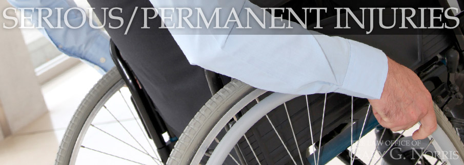 Serious/Permanent Injuries recommended lawyers